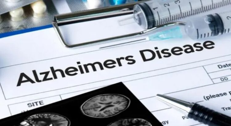 Lanzan al mercado la primera prueba de Alzheimer